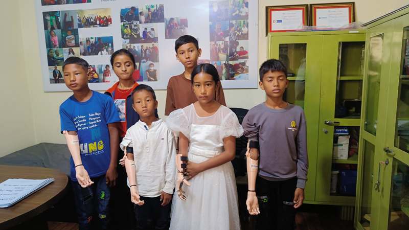 ज्योति विकास बैंकद्वारा बालबालिकाहरुलाई कृत्रिम हात (Prosthetic hand) प्रदान