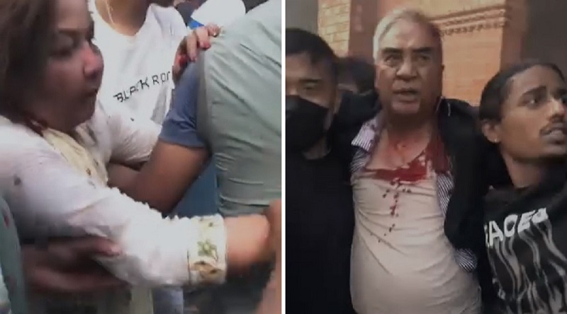 शेर बहादुर देउवा र आरजु राणा  घाइते